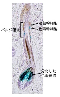 毛包のサイクル