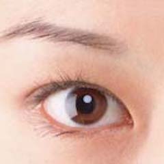 大江橋クリニックの瞼の手術