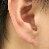 耳の図