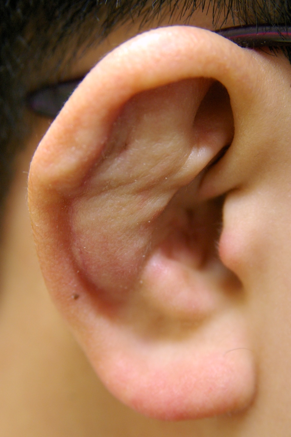 柔道耳術後　大江橋クリニック