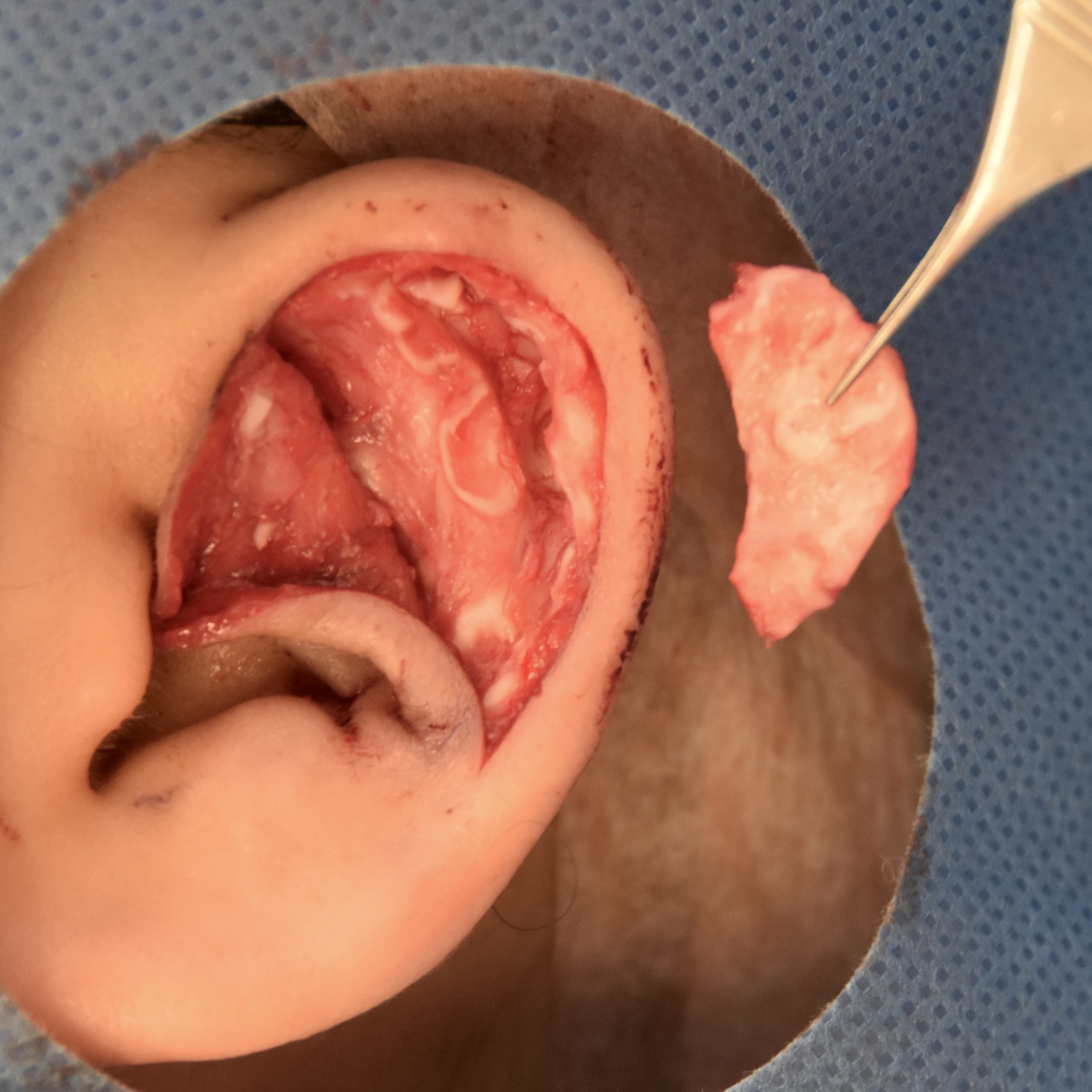 柔道耳術中　大江橋クリニック