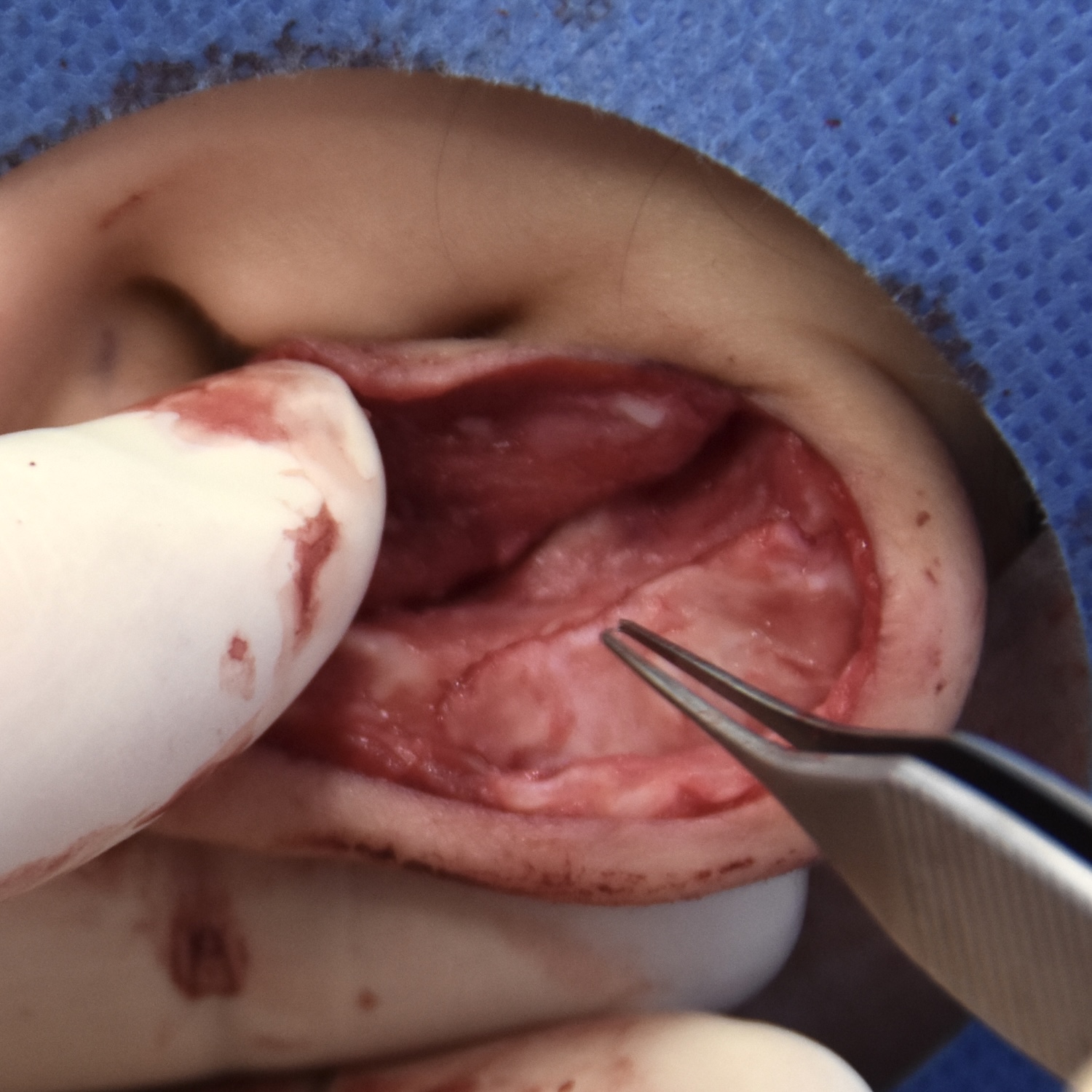 柔道耳術中　大江橋クリニック