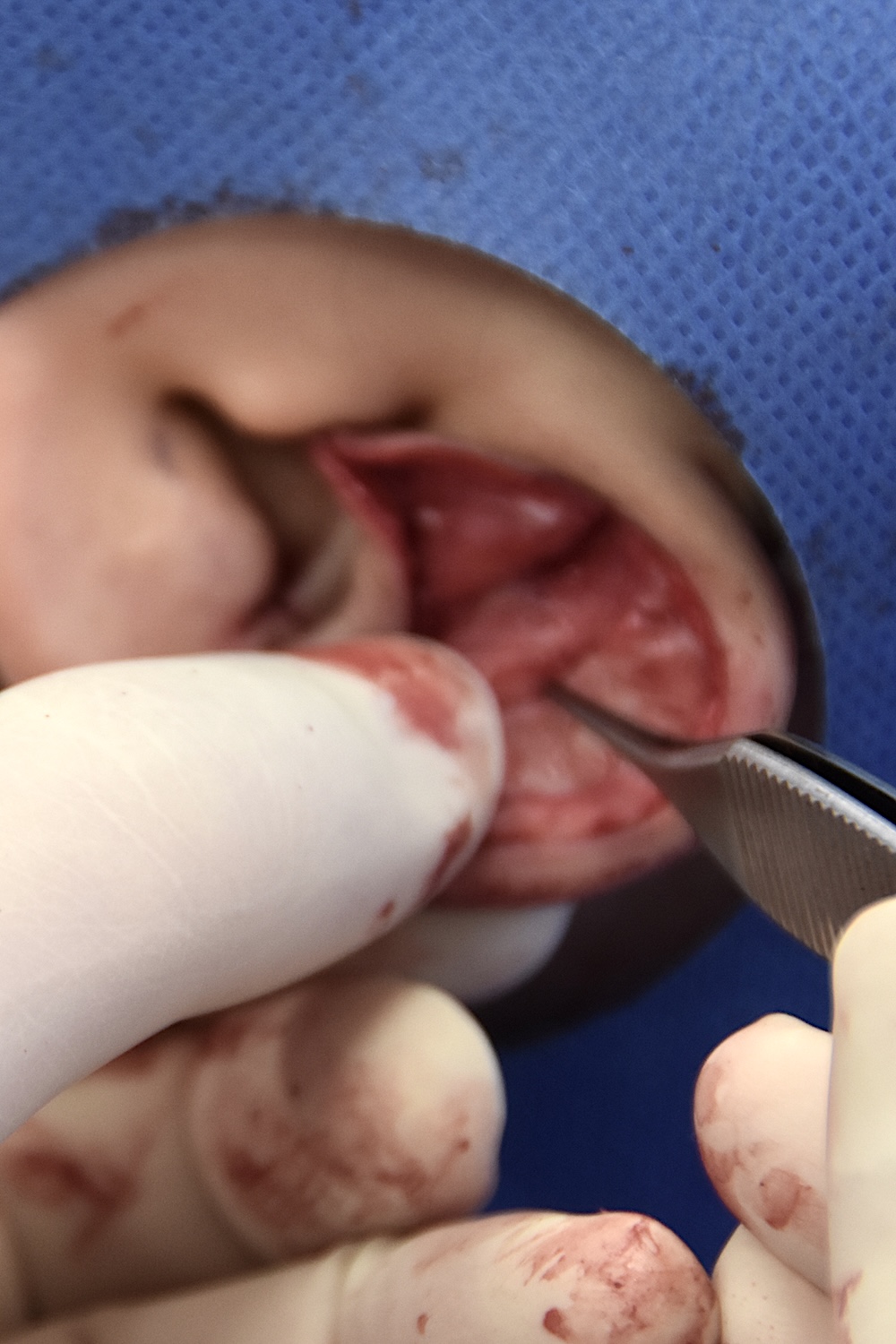 柔道耳術中　大江橋クリニック