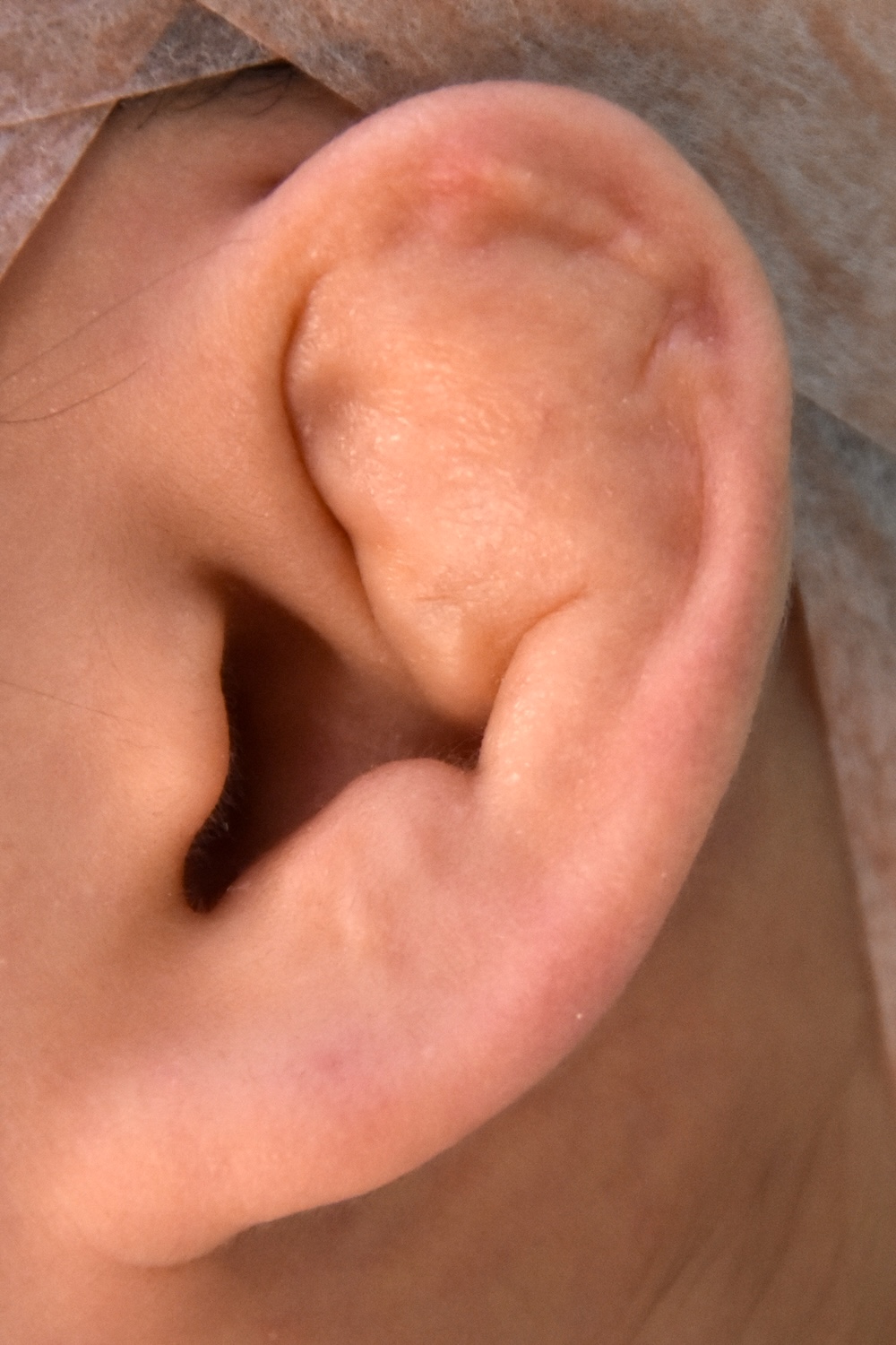 柔道耳術前　大江橋クリニック