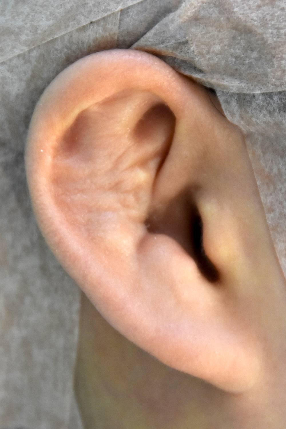 柔道耳術前　大江橋クリニック