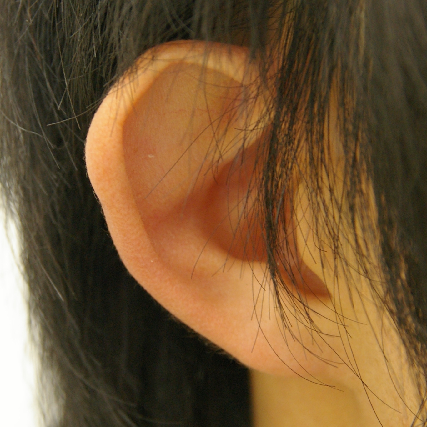 【 完全予約制 】　予約フォームをご利用ください耳介軟骨の特別な性質を詳しく知る耳介形成手術に伴う軟骨移植術、皮弁術、全層植皮術