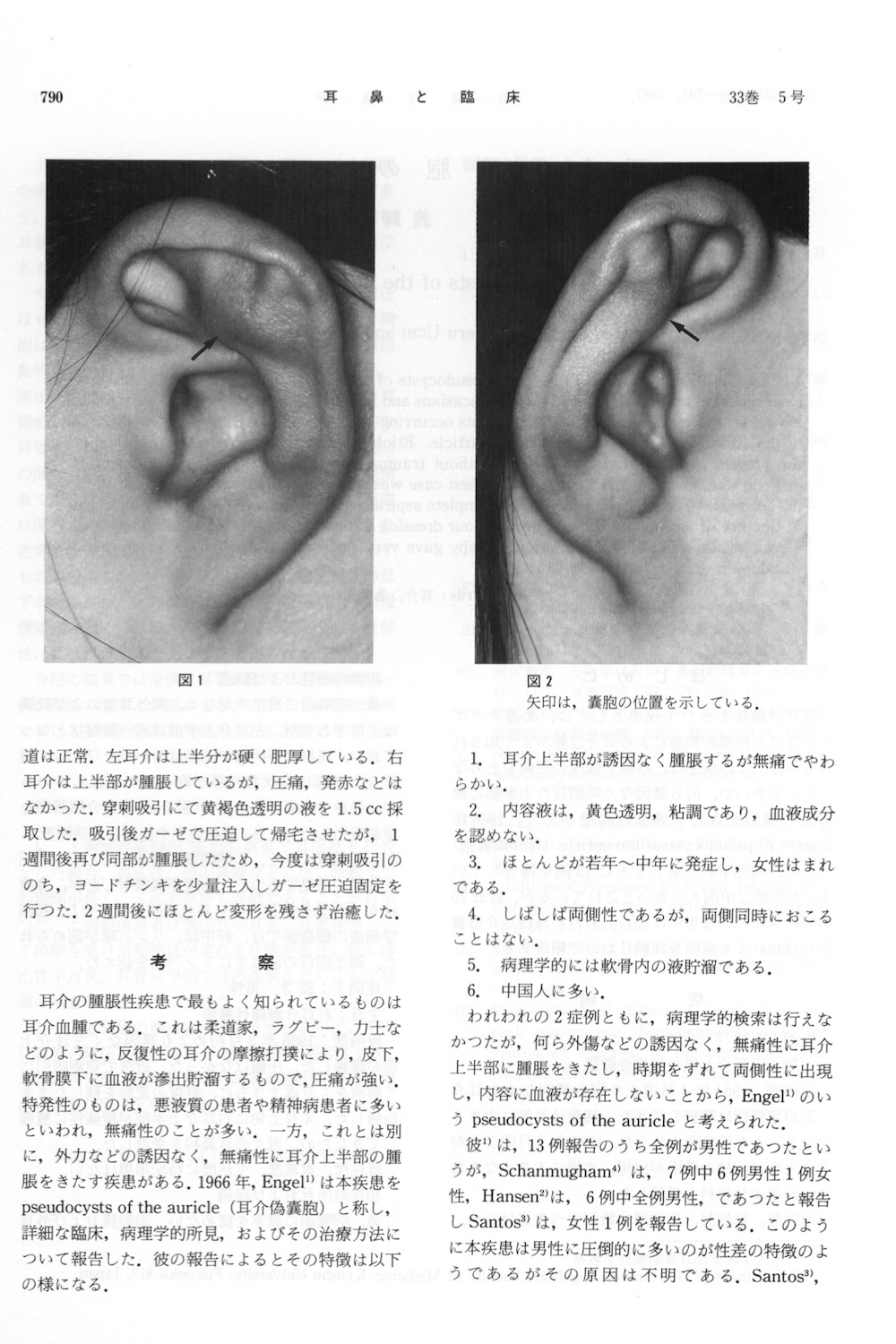 耳介偽嚢腫の報告例